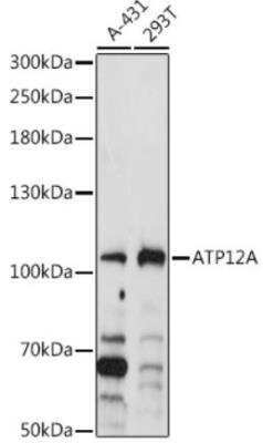 Western Blot: ATP12A AntibodyAzide and BSA Free [NBP2-92160]