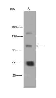 Western Blot: ATP12A Antibody [NBP3-06153]