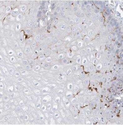 Immunohistochemistry: ATP13A1 Antibody [NBP2-30717]