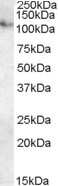 Western Blot: ATP13A1 Antibody [NB100-93378]