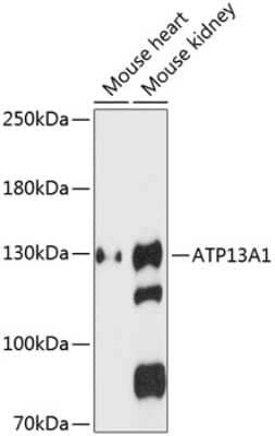 Western Blot: ATP13A1 AntibodyAzide and BSA Free [NBP2-92729]