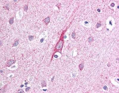 Immunohistochemistry: ATP13A2 Antibody [NB110-41486]