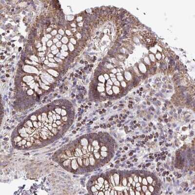 Immunohistochemistry: ATP13A2 Antibody [NBP2-49149]