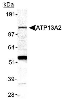 Western Blot: ATP13A2 Antibody [NB110-41486]