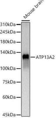 Western Blot: ATP13A2 AntibodyAzide and BSA Free [NBP2-92104]