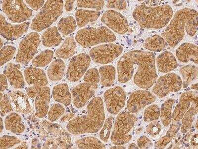 Immunohistochemistry-Paraffin: ATP13A3 Antibody [NBP3-06070]
