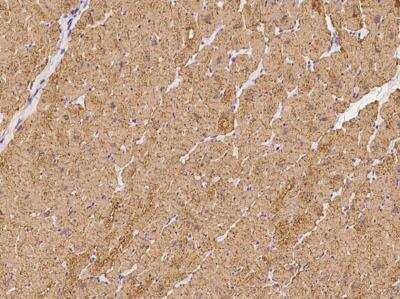 Immunohistochemistry-Paraffin: ATP13A3 Antibody [NBP3-06070]