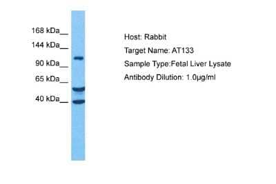 Western Blot: ATP13A3 Antibody [NBP2-82702]