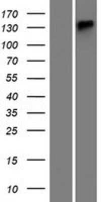 Western Blot: ATP13A4 Overexpression Lysate [NBP2-06049]