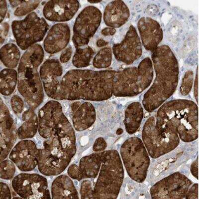 Immunohistochemistry-Paraffin: ATP13A5 Antibody [NBP2-30503]