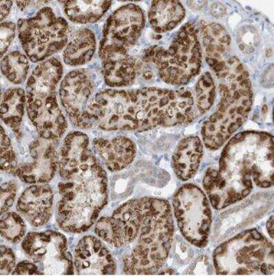 Immunohistochemistry-Paraffin: ATP13A5 Antibody [NBP2-30955]