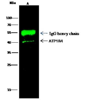 Immunoprecipitation: ATP1B4 Antibody (108) [NBP2-90158]