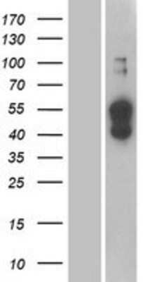 Western Blot: ATP1B4 Overexpression Lysate [NBP2-07496]