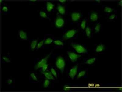 Immunocytochemistry/ Immunofluorescence: ATP2C1 Antibody (2G1) [H00027032-M01]