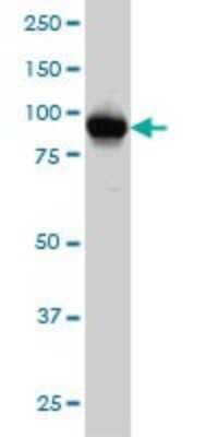 Western Blot: ATP2C1 Antibody (2G1) [H00027032-M01]