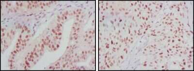 Immunohistochemistry: ATP2C1 Antibody (4G12) - BSA Free [NBP1-47467]