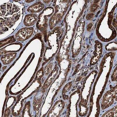 Immunohistochemistry-Paraffin: ATP2C1 Antibody [NBP1-88887]