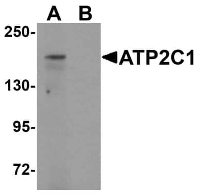 Western Blot: ATP2C1 AntibodyBSA Free [NBP1-76566]