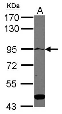 Western Blot: ATP2C1 Antibody [NBP2-15511]