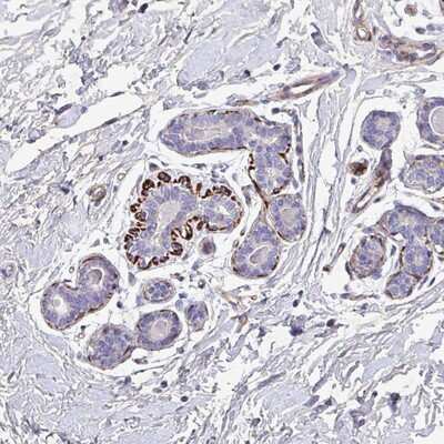 Immunohistochemistry-Paraffin: ATP2C2 Antibody [NBP2-14329]