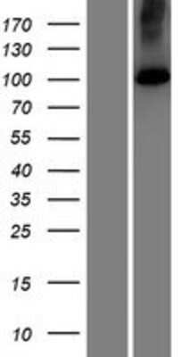 Western Blot: ATP2C2 Overexpression Lysate [NBP2-07263]