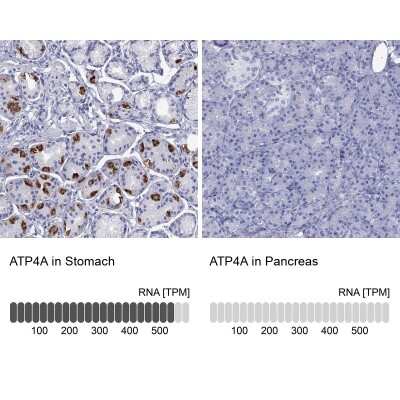 Immunohistochemistry-Paraffin: ATP4A Antibody [NBP3-17134]