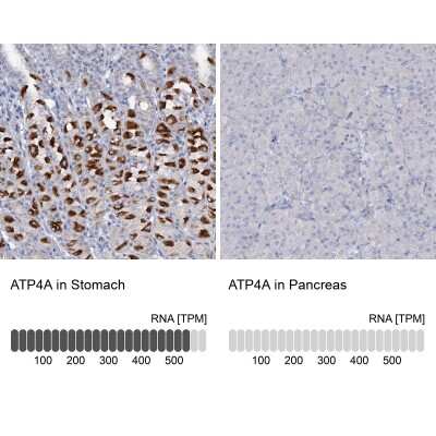 Immunohistochemistry-Paraffin: ATP4A Antibody [NBP1-88889]