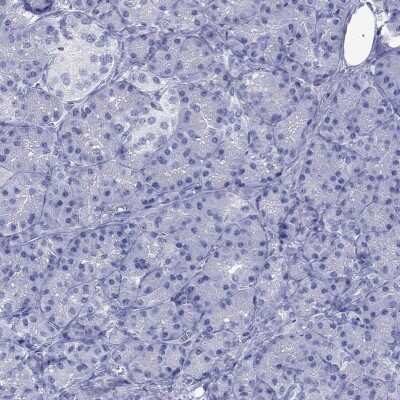Immunohistochemistry-Paraffin: ATP4A Antibody [NBP3-17134]