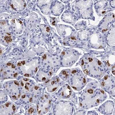 Immunohistochemistry-Paraffin: ATP4A Antibody [NBP3-17134]