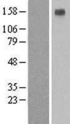 Western Blot: ATP4A Overexpression Lysate [NBL1-07814]
