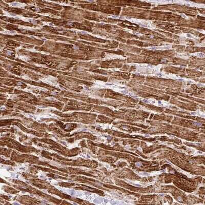 Immunohistochemistry: ATP5A Antibody [NBP2-38525]
