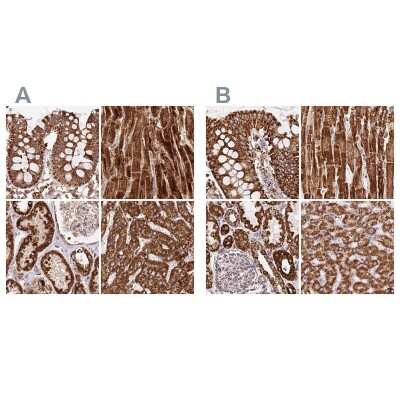Immunohistochemistry-Paraffin: ATP5A Antibody [NBP2-38470]
