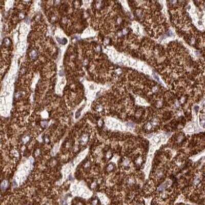Immunohistochemistry-Paraffin: ATP5A Antibody [NBP2-38470]