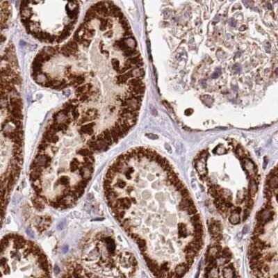 Immunohistochemistry-Paraffin: ATP5A Antibody [NBP2-38470]