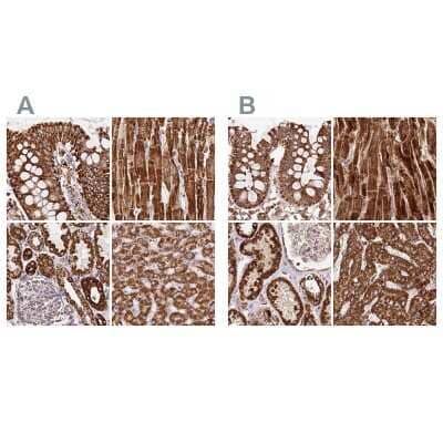 Immunohistochemistry-Paraffin: ATP5A Antibody [NBP2-38525]
