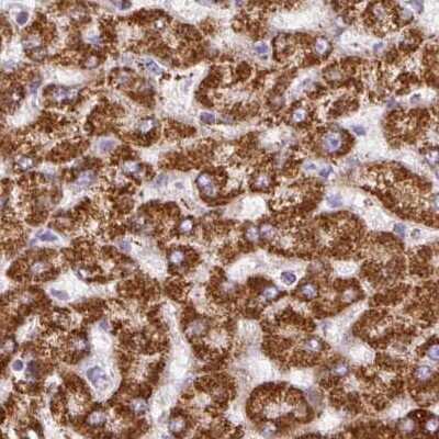 Immunohistochemistry-Paraffin: ATP5A Antibody [NBP2-38525]