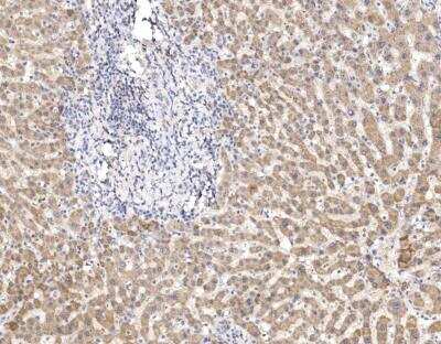 Immunohistochemistry-Paraffin: ATP5A Antibody [NBP3-12789]