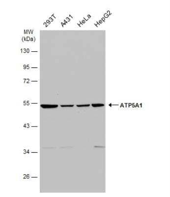 Western Blot: ATP5A Antibody [NBP2-15512]