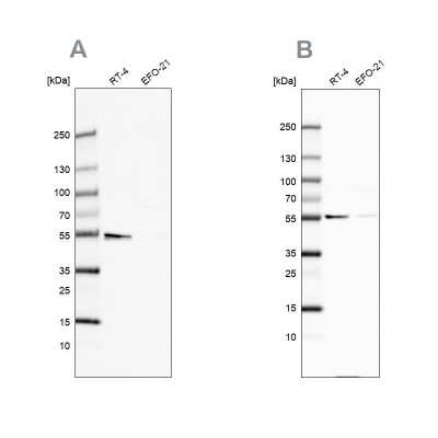 Western Blot: ATP5A Antibody [NBP2-38470]