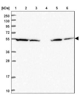 Western Blot: ATP5A Antibody [NBP2-38525]
