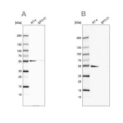 Western Blot: ATP5A Antibody [NBP2-38525]