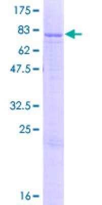 SDS-PAGE: Recombinant Human ATP5A GST (N-Term) Protein [H00000498-P01]