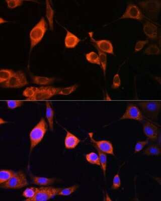 Immunocytochemistry/ Immunofluorescence: ATP5D Antibody - BSA Free [NBP2-92592]