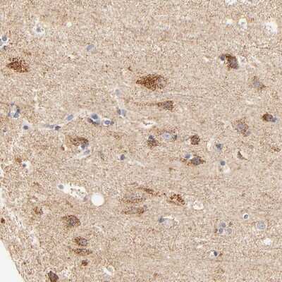Immunohistochemistry-Paraffin: ATP5D Antibody [NBP1-86162]