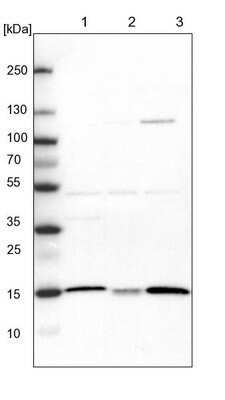 Western Blot: ATP5D Antibody [NBP1-86162]