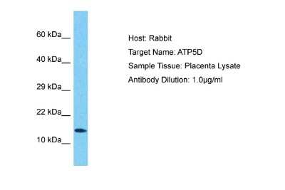 Western Blot: ATP5D Antibody [NBP2-84480]