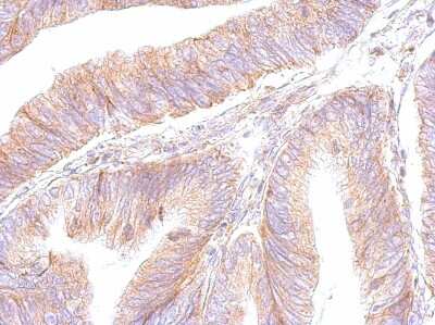 Immunohistochemistry-Paraffin: ATP5F1 Antibody [NBP1-33465]