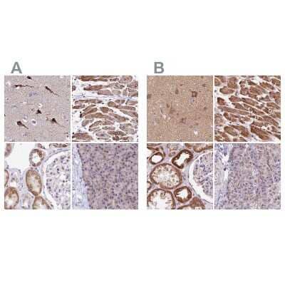 Immunohistochemistry-Paraffin: ATP5F1 Antibody [NBP1-91689]