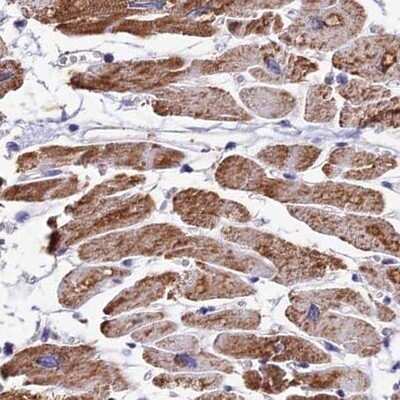 Immunohistochemistry-Paraffin: ATP5F1 Antibody [NBP1-91689]