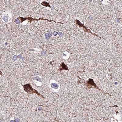 Immunohistochemistry-Paraffin: ATP5F1 Antibody [NBP1-91689]